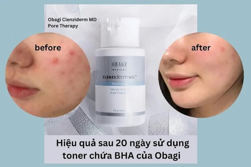 Dâu tây và chanh se khít lỗ chân lông